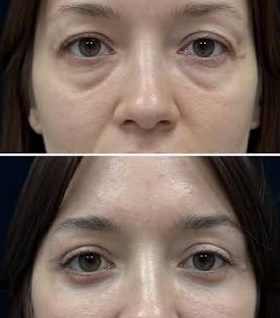Результат до та після